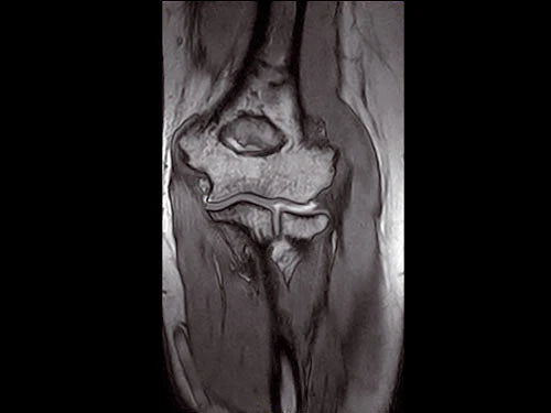 ESAOTE O-SCAN eXP 2016 - Dedicate MRI for Extremities with Cage