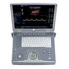 GE Logiq i Portable Ultrasound System