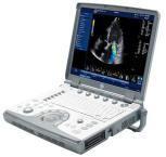 GE Vivid e Portable Ultrasound System