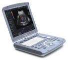 GE Voluson e Portable Ultrasound System