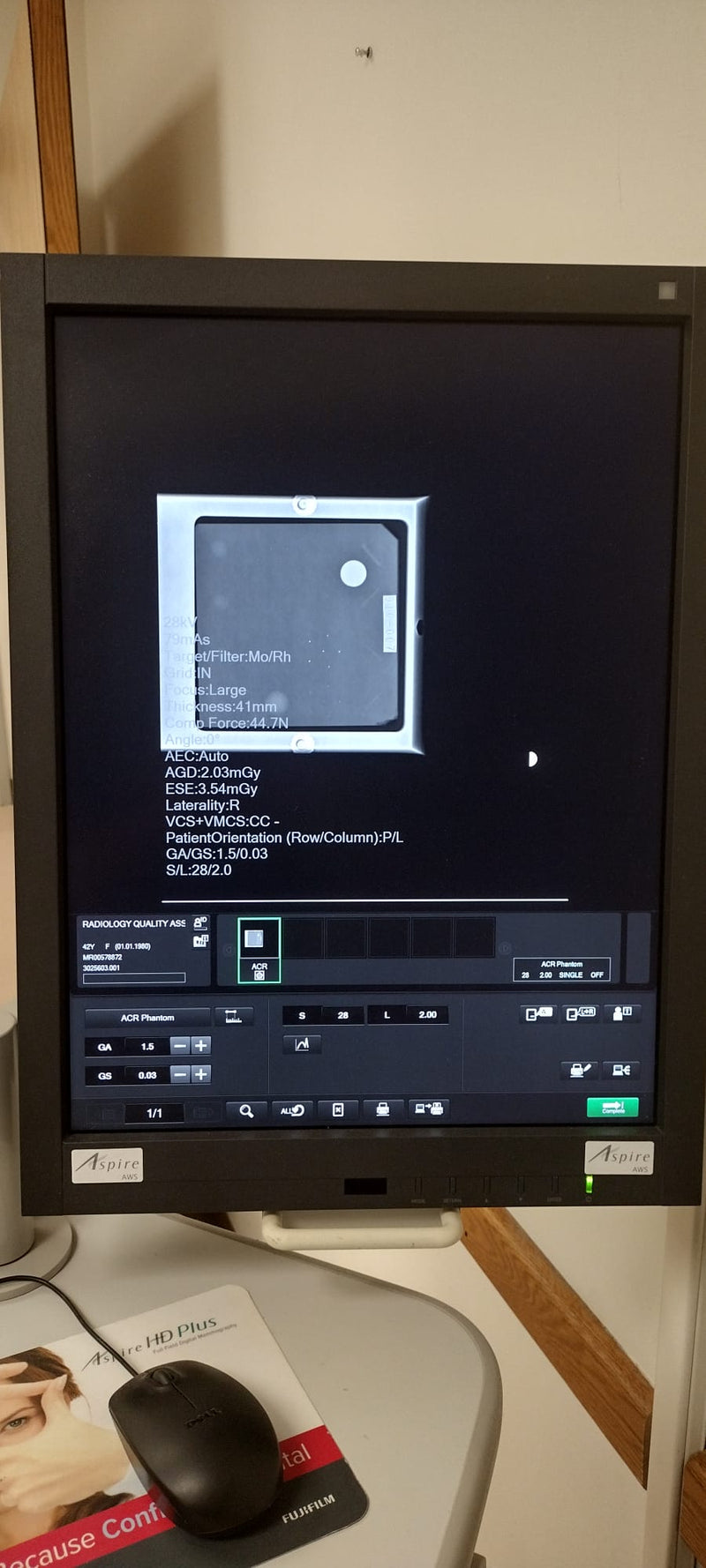2012 Fujifilm Aspire HD Mammogram Unit